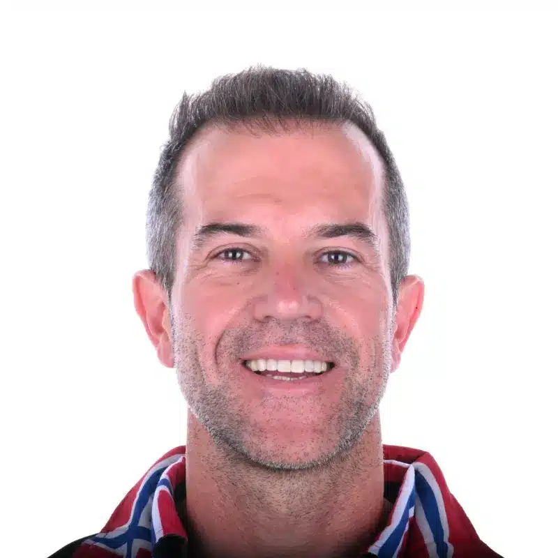 caso real diseño de sonrisa resultado despues del tratamiento en arteo dental