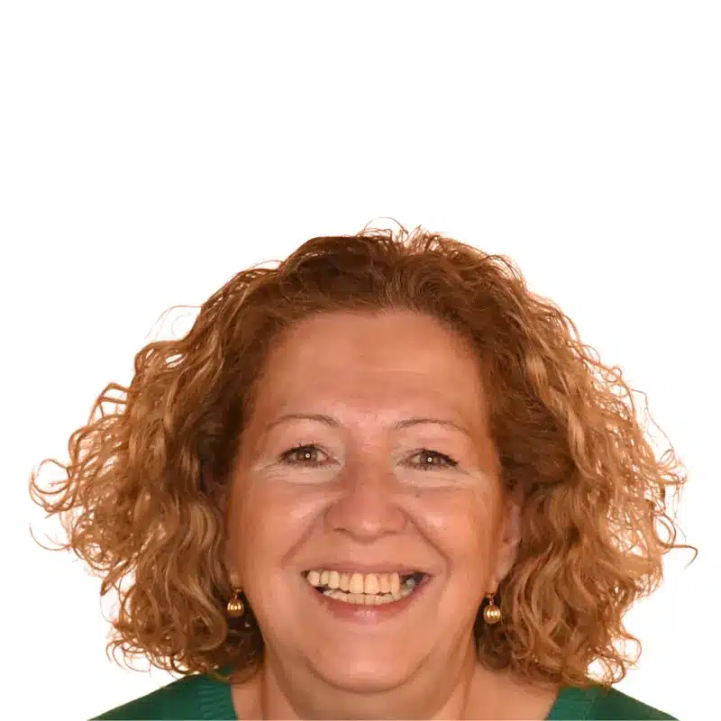 caso real de teresa con una rehabiliacion personalizada antes
