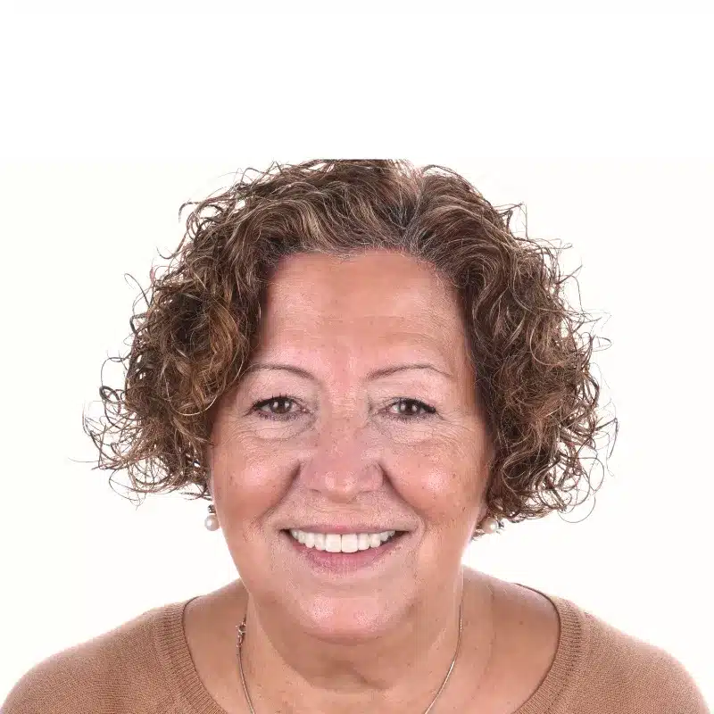 caso real de teresa con una rehabiliacion personalizada despues del tratamiento en arteo dental